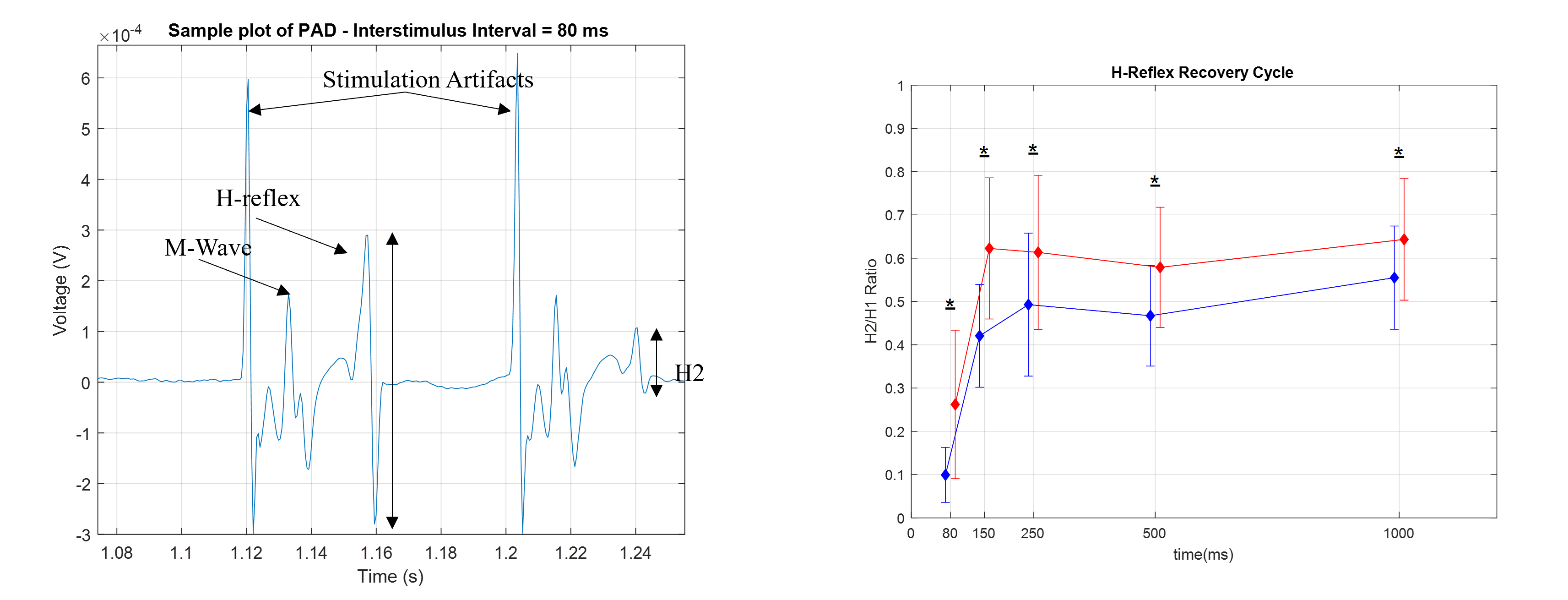 H-Reflex Measurements